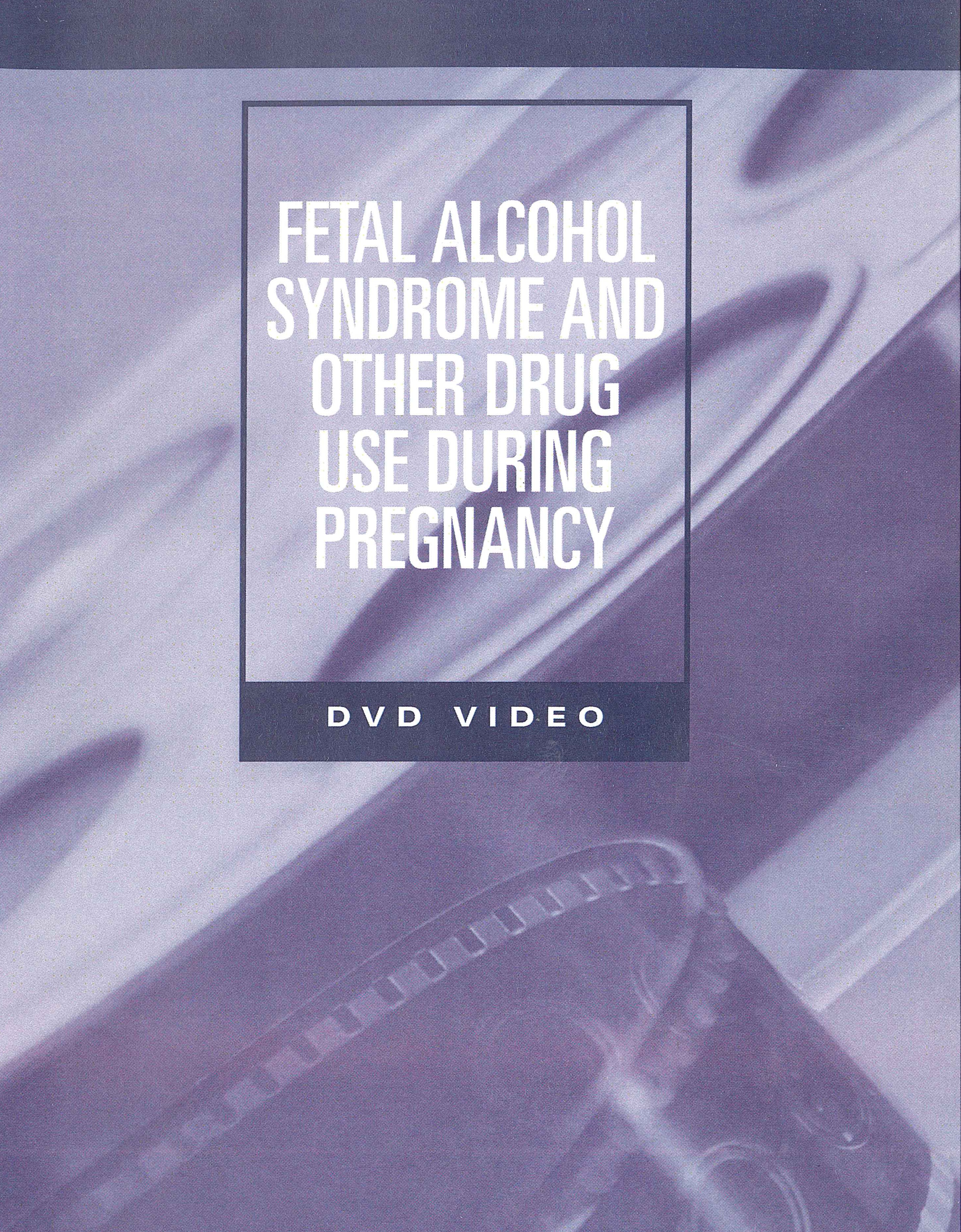 Fetal Alcohol Syndrome and Other Drug Use During Pregnancy