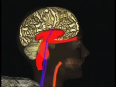 Heroin: From Pleasure to Pain